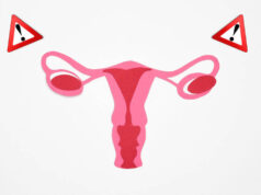 Cáncer de Ovario