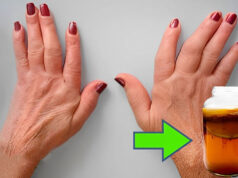 Descubre cómo aliviar los síntomas de la artritis con estos remedios caseros artritis soluciones