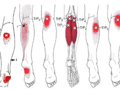 fibromialgia y sus enfermedades