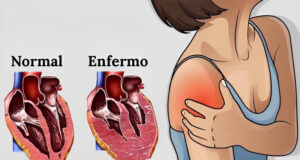 síntomas corazón enfermo