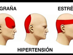 Dolor de cabeza: Alternativas no farmacológicas para encontrar alivio Dolor de cabeza
