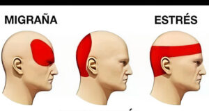 Dolor de cabeza