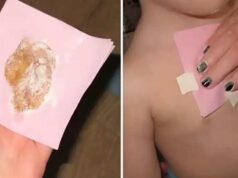 Jengibre en el Pecho: Un Remedio Casero para Despejar los Pulmones jengibre pecho