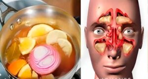 REMEDIO PARA LA CONGESTIÓN NASAL PORTADA