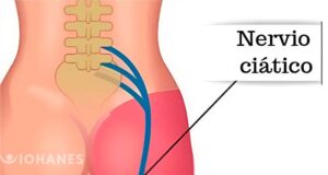 5 EJERCICIOS PARA EL NERVIO CIÁTICO PORTADA