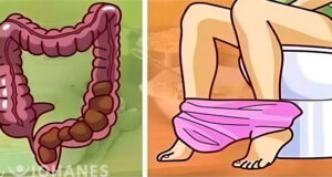 LIMPIA EL COLON PORTADA