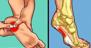 EJERCICIOS PARA LA FASCITISDE TALÓN
