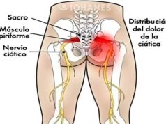 Deshazte del Dolor del Nervio Ciático en Menos de 10 Minutos con Este Método Natural NERVIO CIATICO EN 10 MINUTOS