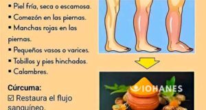 MALA CIRCULACIÓN REMEDIO DE LA CÚRCUMA